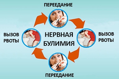 Лечение булимии в Шалушке